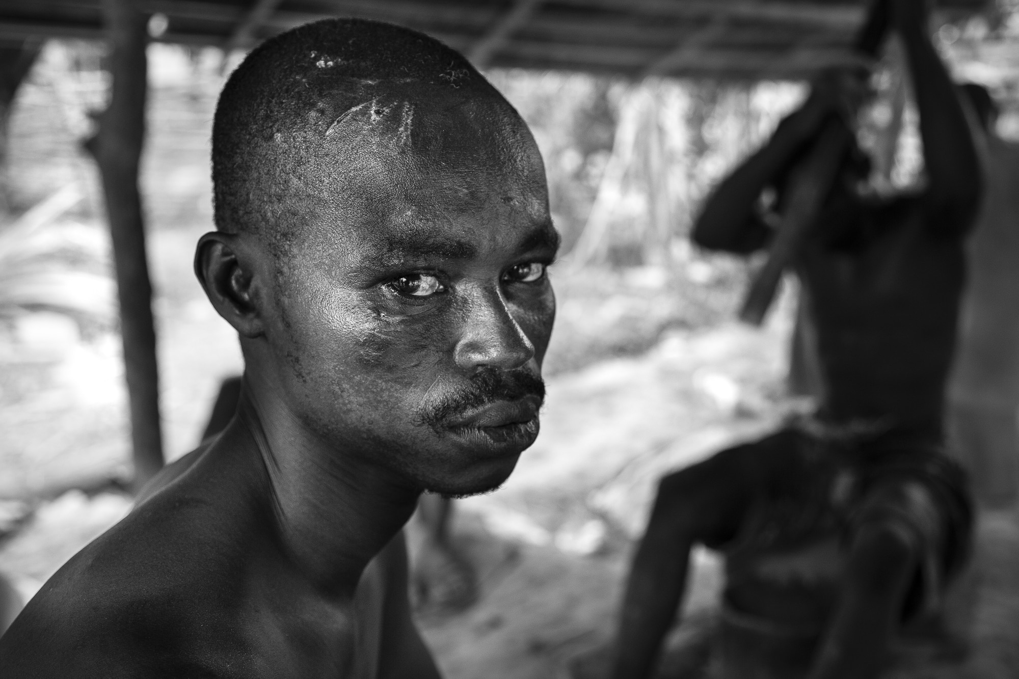 Wounded man in Ghana